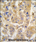 MIPEP Antibody (Center)